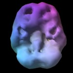 ADHD 3 - - Neuromedis Tip 2 – Nepozornostni add