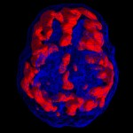 ADHD 7 - - Neuromedis Tip 6 – ¨Ring of fire¨ ADD